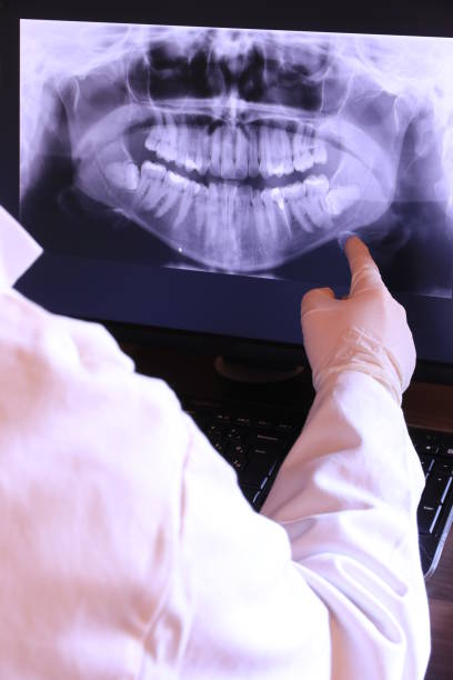 Best Emergency Wisdom Teeth Removal in Irvine, CA